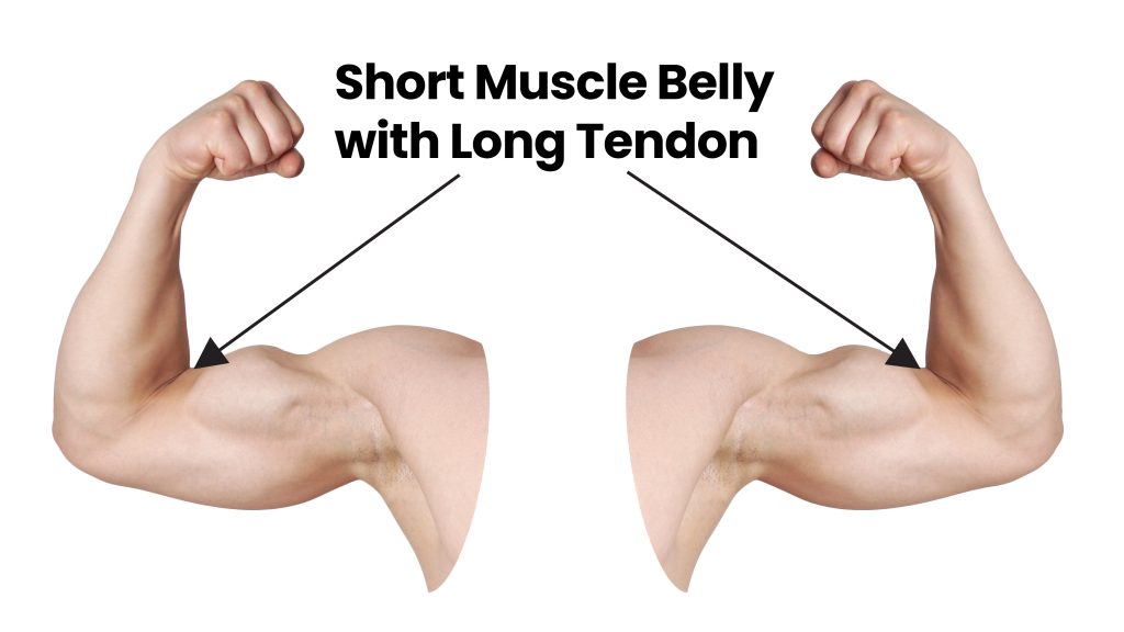 muscle insertion