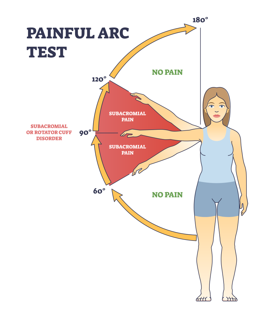 shoulder painful arc test