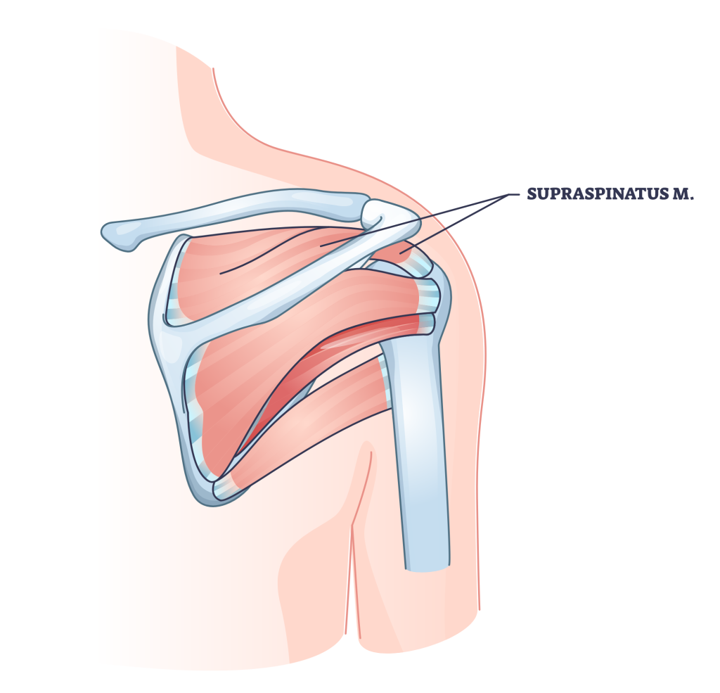 supraspinatus muscle