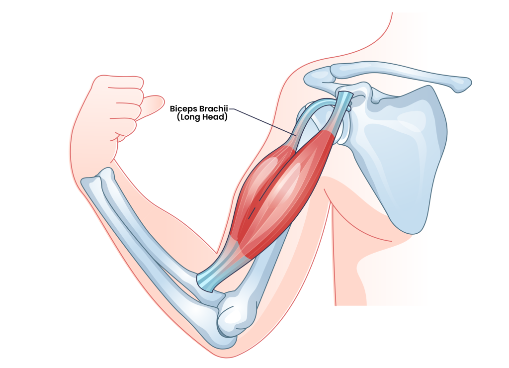 long head bicep brachii